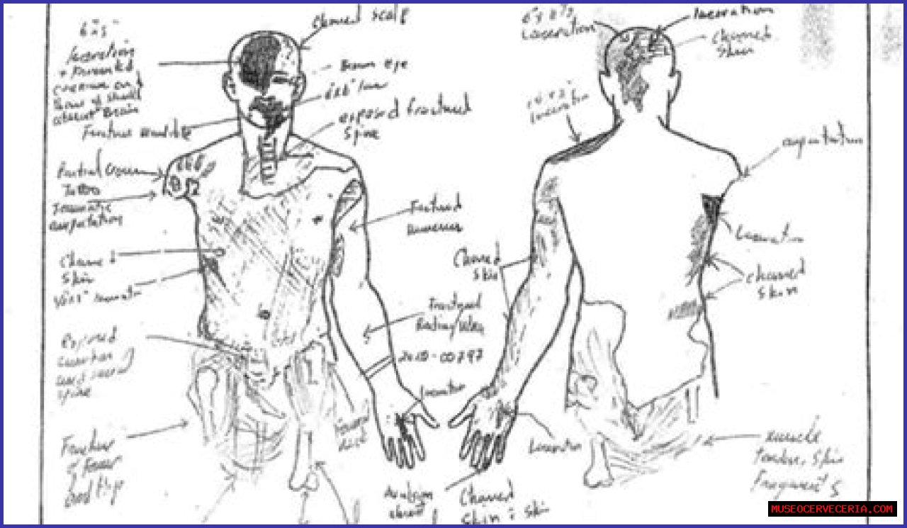 Kobe Bryant And Gigi Autopsy Twitter Sketch On Reddit, Photos And Videos Of Crash Explained